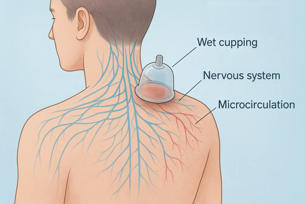 wet cupping Stress hormonal system