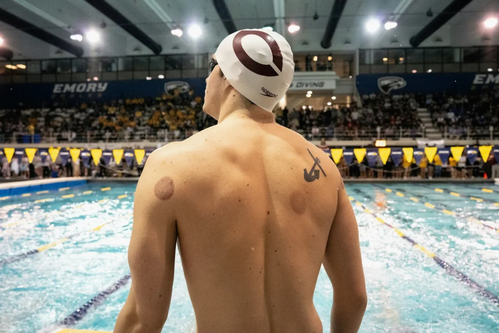 dry vs wet cupping for athlete
