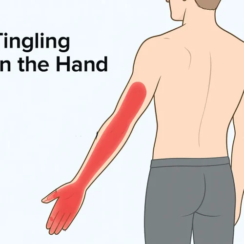 Hand Tingling: Why It Happens and How Wet Cupping Helps Restore Nerve Flow and Finger Comfort