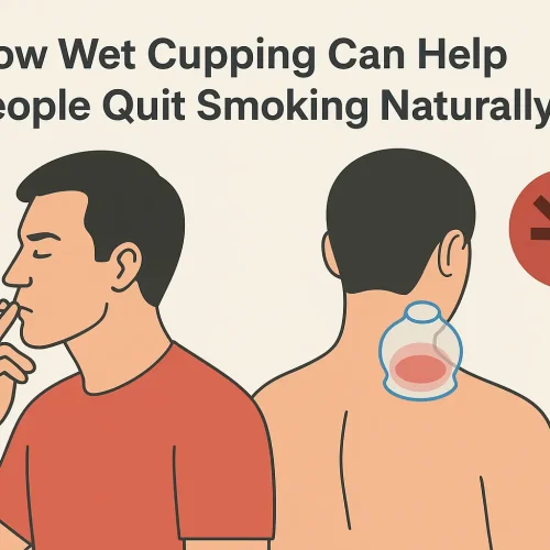 How Wet Cupping Can Help People Quit Smoking Naturally
