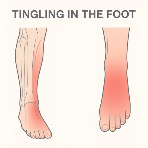 Foot Tingling: Why It Happens and How Wet Cupping Helps Restore Nerve Flow and Lightness