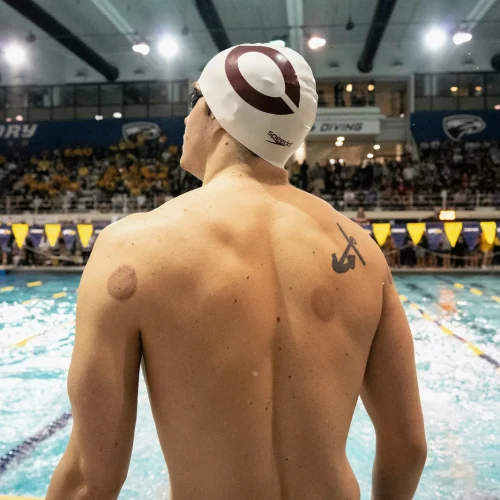 Why Many Athletes Use Dry Cupping — and Why Wet Cupping Might Go Further