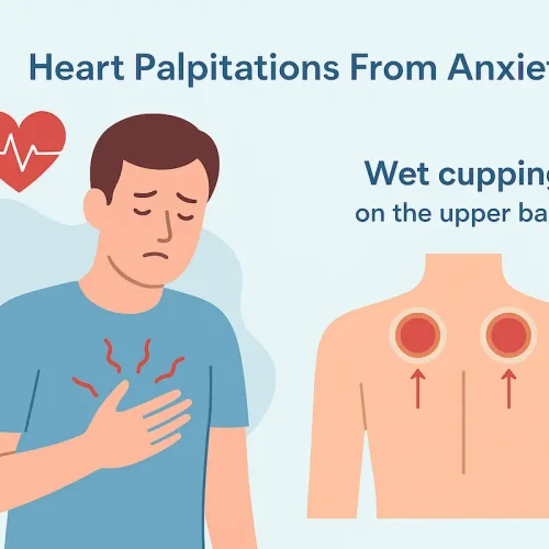 Heart Palpitations From Anxiety — Why It Happens and How Upper-Back Wet Cupping Helps You Feel Calmer