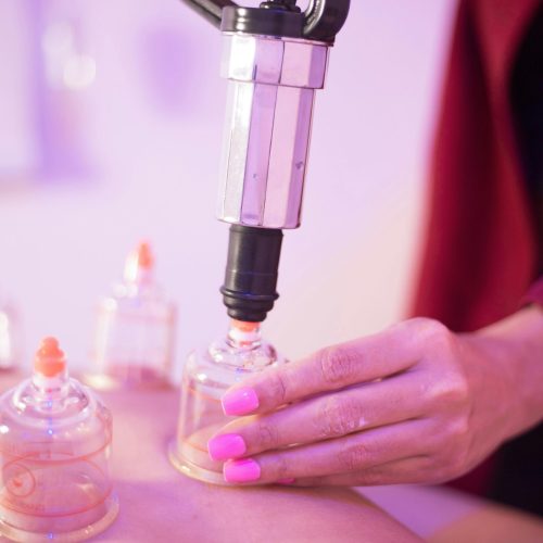 Dry vs Wet Cupping (Hijama): What’s the Difference and Which Is Better for You?
