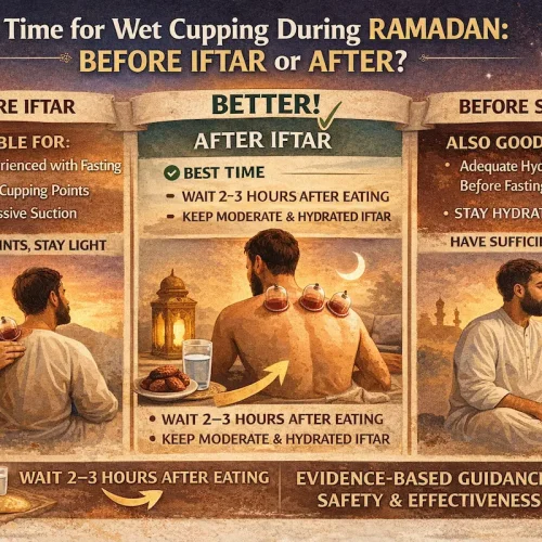 Best Time for Wet Cupping During Ramadan: Before Iftar or After?